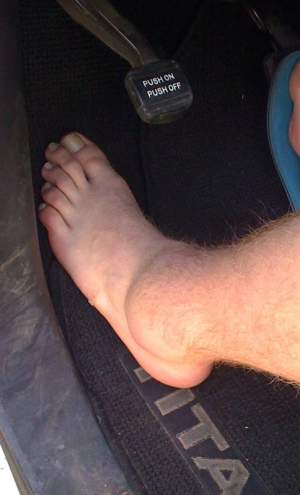 That’s Josh Hill’s ankle…. Ouch!